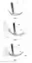 Fig. 07 - Laryngoscope, comprising a set of magnetic elements