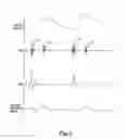 Fig. 02 - PULSE DETECTION APPARATUS, SOFTWARE, AND METHODS USING PATIENT PHYSIOLOGICAL SIGNALS