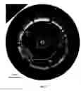 Fig. 05 - METHODS FOR INTRAVASCULAR IMAGING AND FLUSHING