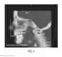 Fig. 06 - Diagnosing Airway Obstructions