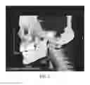 Fig. 08 - Diagnosing Airway Obstructions