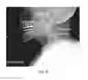 Fig. 09 - Diagnosing Airway Obstructions