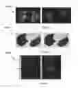 Fig. 44 - Chemically-selective, label free, microendoscopic system based on coherent anti-stokes raman scattering and microelectromechanical fiber optic probe