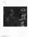 Fig. 46 - Chemically-selective, label free, microendoscopic system based on coherent anti-stokes raman scattering and microelectromechanical fiber optic probe