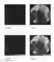 Fig. 50 - Chemically-selective, label free, microendoscopic system based on coherent anti-stokes raman scattering and microelectromechanical fiber optic probe