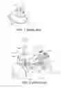 Fig. 02 - METHOD AND A SYSTEM FOR MEDICAL IMAGING
