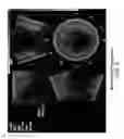 Fig. 08 - METHOD AND A SYSTEM FOR MEDICAL IMAGING