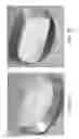 Fig. 09 - METHOD AND A SYSTEM FOR MEDICAL IMAGING