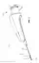Fig. 02 - Biopsy Device with Integral Needle Tip Protector