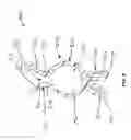 Fig. 09 - Biopsy Device with Detachable Needle Tip Protector