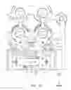 Fig. 33 - Method of sensing forces on a working instrument