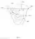 Fig. 16 - Method and system for aligning a prosthesis during surgery using active sensors