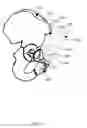 Fig. 17 - Method and system for aligning a prosthesis during surgery using active sensors
