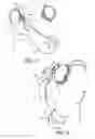 Fig. 05 - Harness