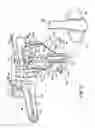 Fig. 03 - Adjustable extension compression posterior spinal orthosis and method