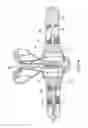 Fig. 05 - Adjustable extension compression posterior spinal orthosis and method