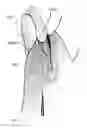 Fig. 01 - SHOULDER STABILISING DEVICE