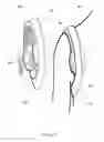 Fig. 10 - SHOULDER STABILISING DEVICE