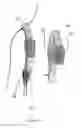 Fig. 13 - SHOULDER STABILISING DEVICE