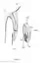 Fig. 14 - SHOULDER STABILISING DEVICE