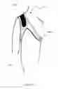 Fig. 16 - SHOULDER STABILISING DEVICE