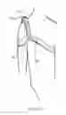 Fig. 17 - SHOULDER STABILISING DEVICE