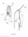 Fig. 20 - SHOULDER STABILISING DEVICE