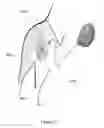 Fig. 31 - SHOULDER STABILISING DEVICE