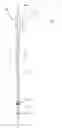 Fig. 01 - Venous closure catheter and method for sclerotherapy