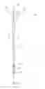 Fig. 04 - Venous closure catheter and method for sclerotherapy