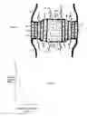 Fig. 03 - Alleviate back pain with lactic acid inhibitors