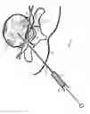 Fig. 06 - Alleviate back pain with lactic acid inhibitors