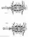 Fig. 07 - Alleviate back pain with lactic acid inhibitors