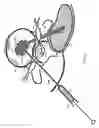 Fig. 08 - Alleviate back pain with lactic acid inhibitors
