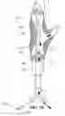 Fig. 10 - System and method for embolic protection
