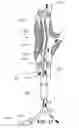 Fig. 12 - System and method for embolic protection