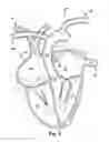 Fig. 07 - Method for increasing blood flow in or about a cardiac or other vascular or prosthetic structure to prevent thrombosis