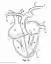 Fig. 12 - Method for increasing blood flow in or about a cardiac or other vascular or prosthetic structure to prevent thrombosis