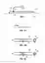Fig. 02 - Bypass vascular graft
