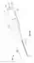 Fig. 05 - Ocular implant with stiffness qualities, methods of implantation and system