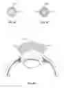 Fig. 08 - Ocular implant with stiffness qualities, methods of implantation and system