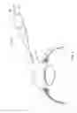 Fig. 09 - Ocular implant with stiffness qualities, methods of implantation and system