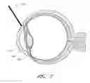 Fig. 10 - DISPOSABLE HANDHELD PHACOMORCELLATION DEVICE