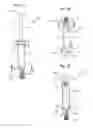 Fig. 06 - Syringe, system and method for delivering oxygen-ozone