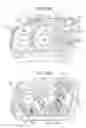 Fig. 29 - Dialysis system having disposable cassette