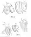 Fig. 03 - ORAL FLUID DELIVERY DEVICE