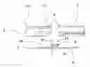 Fig. 01 - EXTRA-CORPOREALLY PORTABLE INFUSION DEVICE