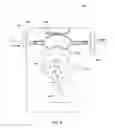 Fig. 09 - Manual pump for intravenous fluids