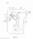 Fig. 10 - Manual pump for intravenous fluids