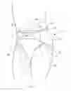 Fig. 02 - Two-piece wearable absorbent article with advantageous fastener performance configurations